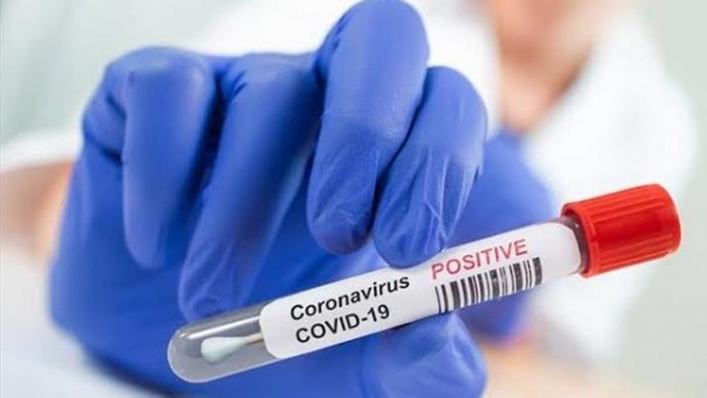 Son bir həftədə Moldovada 10 minə yaxın insan koronavirusa yoluxub