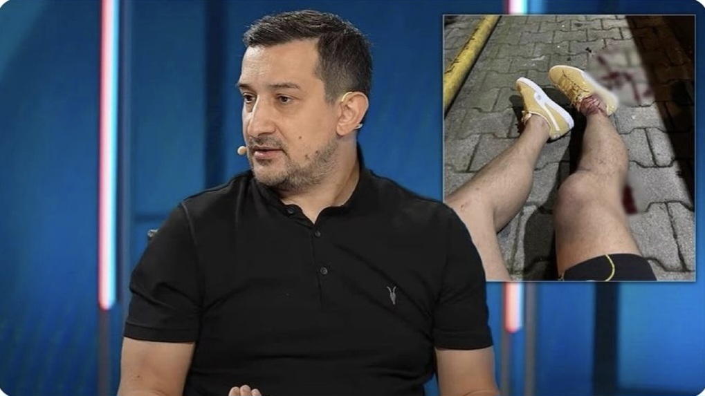 Keçmiş futbolçuya silahlı hücum oldu