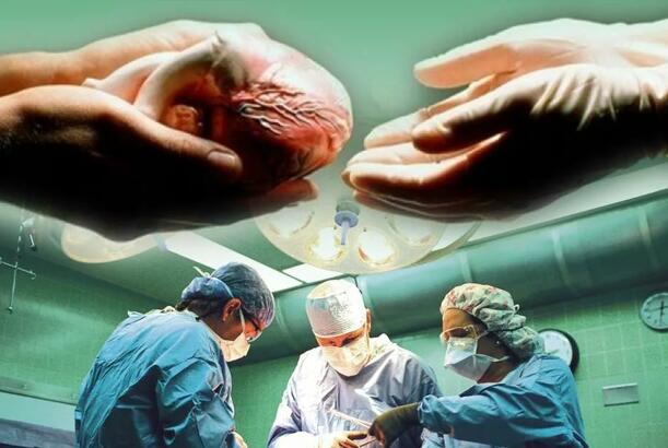 İslamın orqan donorluğu və transplantasiyasına münasibəti...