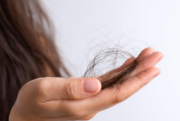 Mövsümi saç tökülməsini keçəllikdən necə ayırd etməli..?