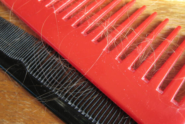 Keçəlliyin qarşısını necə almaq olar..?