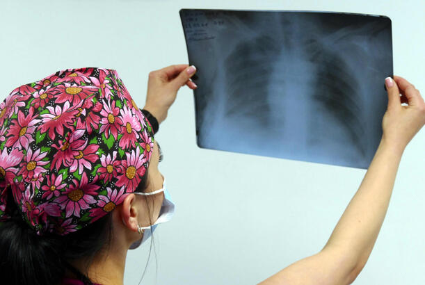 Ağciyər xərçənginin incə bir simptomu müəyyən edilib...