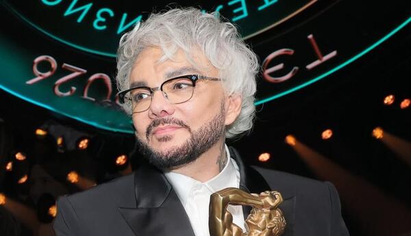 Filipp Kirkorov burnunu əməliyyat etdirdi, söz-söhbət bitmədi...