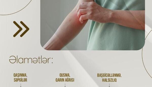 "Qida allergiyaları ilə bağlı məlumatlılığın artması müraciətlərin sayını artırıb" <span class="red">- EKSPERT </span>