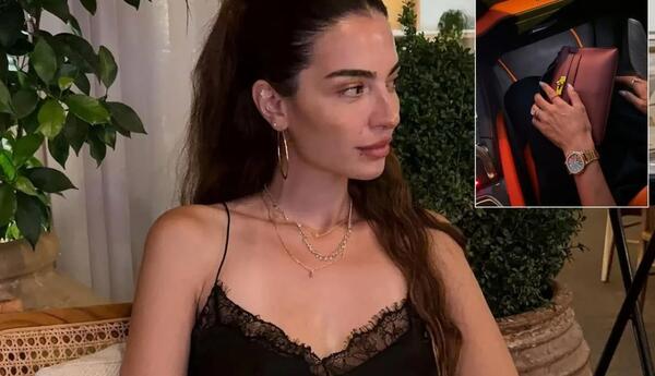 Türkiyəli aktrisadan PAYLAŞIM - 2 milyonluq "Lamborghini", 353 minlik qızıl saat...