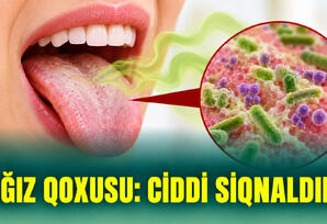 Ağız Qoxusu: Ciddi Siqnaldır Ağız Qoxusu: Ciddi Siqnaldır